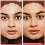 Super BB Concealer (10ml) - 5 Options
